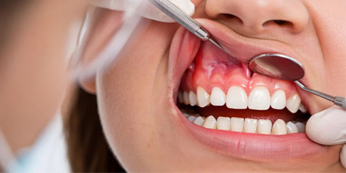 Periodontics Service